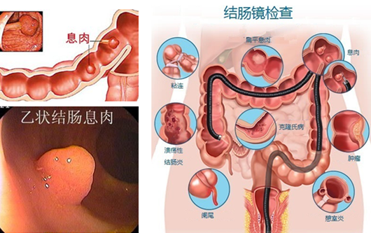 大便很干拉不出来