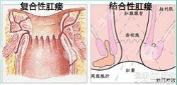 泉州肛肠医院