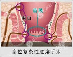 泉州肛肠医院